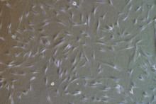 Human mesenchymal stem cells